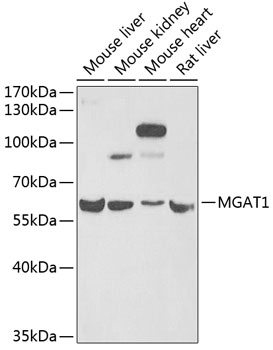 a05341 mgat1 primary antiboties wb testing 1