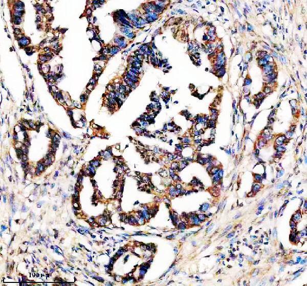 IHC analysis of Syntaxin 4/STX4 using anti-Syntaxin 4/STX4 antibody (A05345-1)