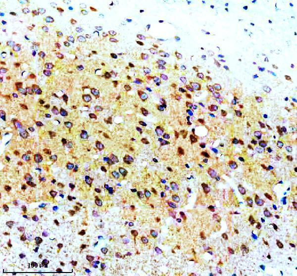 IHC analysis of Syntaxin 4/STX4 using anti-Syntaxin 4/STX4 antibody (A05345-1)
