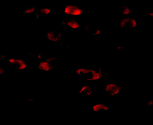 a05347 tmem18 primary antibodies if testing 3