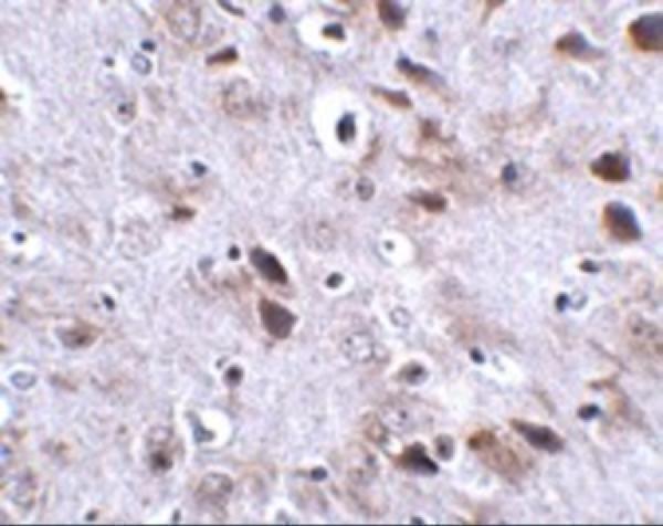 a05347 tmem18 primary antibodies ihc testing 2