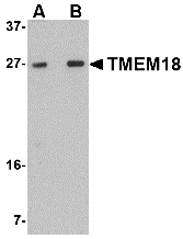 a05347 tmem18 primary antibodies wb testing 1