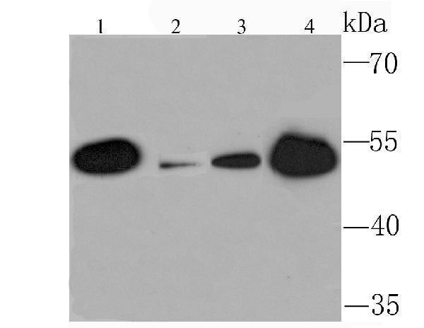 a05349 1 kmt5a primary antiboties wb testing 1
