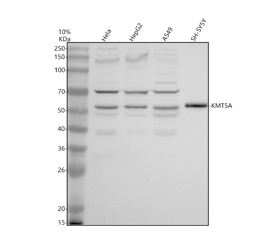 Western blot analysis of KMT5A using anti-KMT5A antibody (A05349-2)