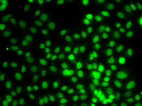 Immunofluorescence analysis of MCF-7 cells using KMT5A/KMT5A/SETD8 antibody 