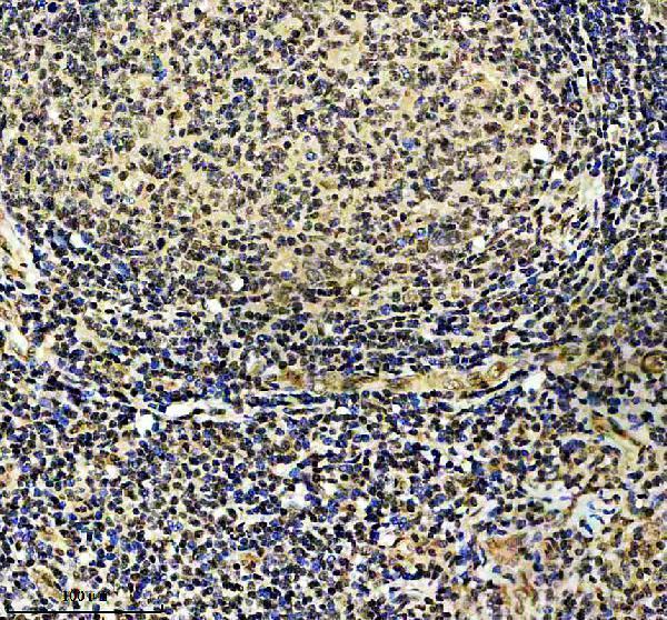 IHC analysis of GABPA using anti-GABPA antibody (A05350-2)