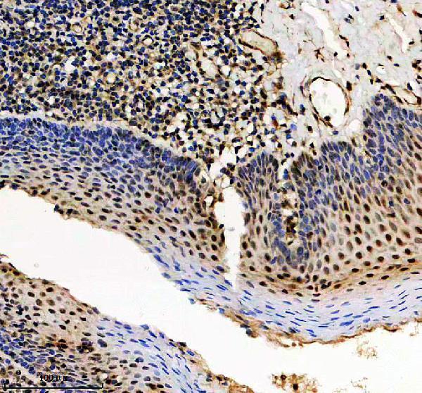 IHC analysis of GABPA using anti-GABPA antibody (A05350-2)