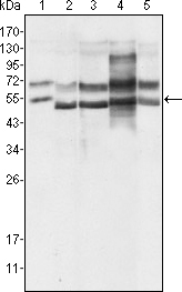 Western Blot analysis using GABP-α Monoclonal Antibody against HeLa (1), A549 (2), MCF-7 (3), NIH/3T3 (4) and SMMC-7721 (5) cell lysate