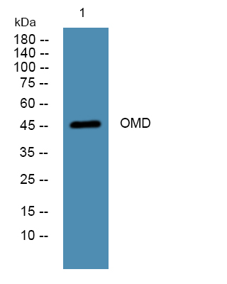 Western blot analysis of lysates from K562 cells, primary antibody was diluted at 1:1000, 4°over night