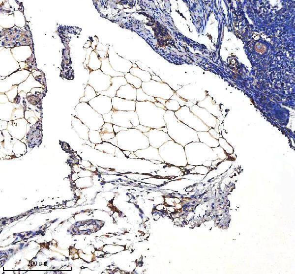 a05352 2 serpina12 primary antibodies ihc testing 2