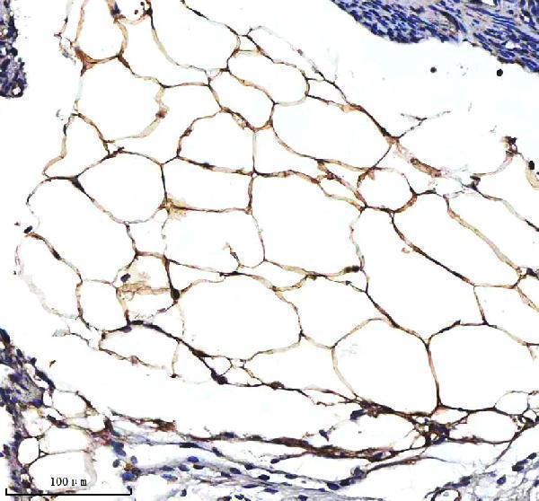 a05352 2 serpina12 primary antibodies ihc testing 3