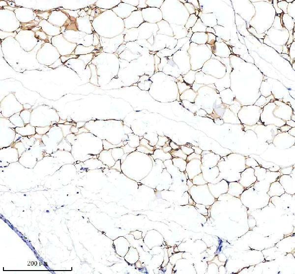 a05352 2 serpina12 primary antibodies ihc testing 4
