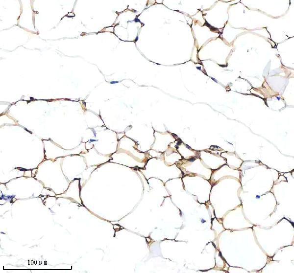 a05352 2 serpina12 primary antibodies ihc testing 5