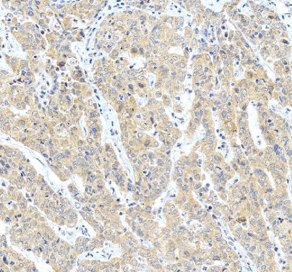 IHC analysis of Vaspin/SERPINA12 using anti-Vaspin/SERPINA12 antibody (A05352-2)