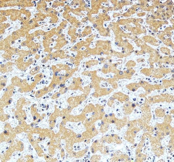 IHC analysis of Vaspin/SERPINA12 using anti-Vaspin/SERPINA12 antibody (A05352-2)