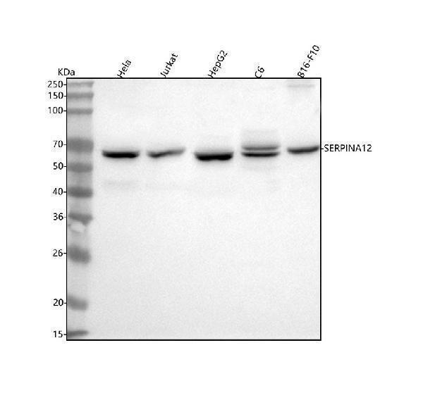  Western blot analysis of Vaspin/SERPINA12 using anti-Vaspin/SERPINA12 antibody (A05352-2)