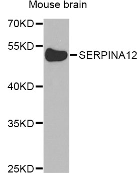 Western blot analysis of extracts of mouse brain, using SERPINA12 Antibody