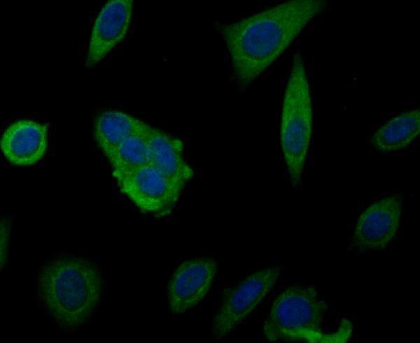 Immunocytochemistry staining MARK3 in MCF-7 cells (green)