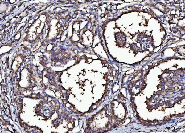  IHC analysis of MARK3 using anti-MARK3 antibody (A05355-2)