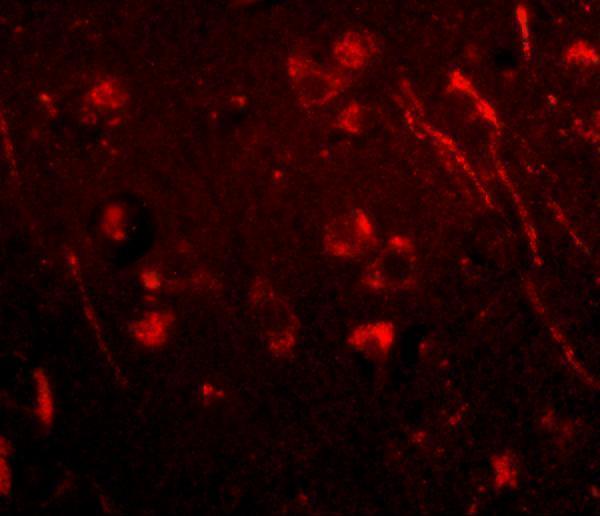 Immunofluorescence of aipl1 in human brain tissue with aipl1 antibody at 20 μg/mL