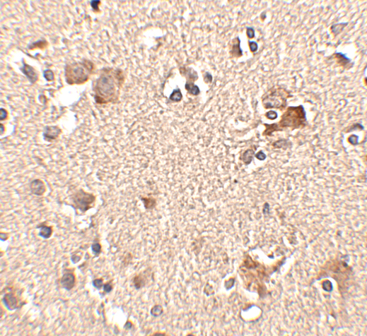 Immunohistochemistry of Aipl1 in human brain tissue with Aipl1 antibody at 2