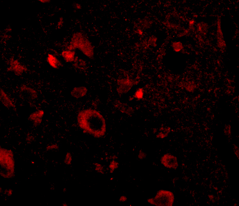 a05356 aipl1 primary antibodies if testing 3