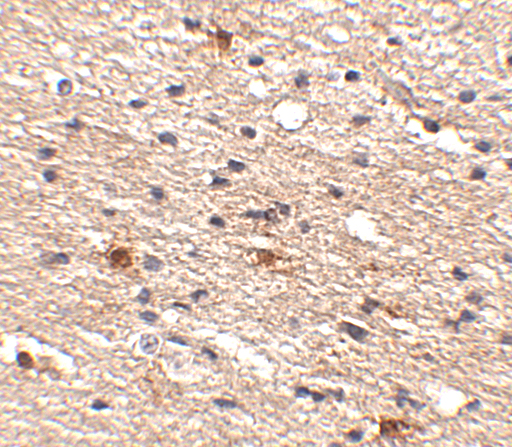 a05356 aipl1 primary antibodies ihc testing 2
