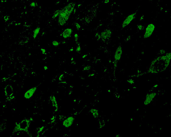 a05357 1 mlst8 primary antibodies if testing 3