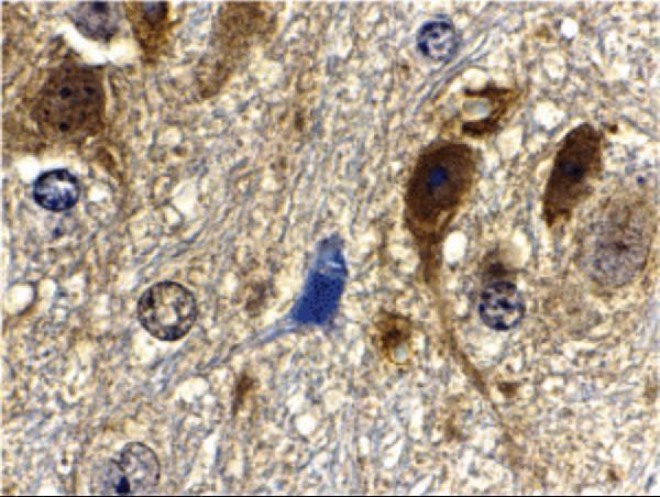 a05357 1 mlst8 primary antibodies ihc testing 2