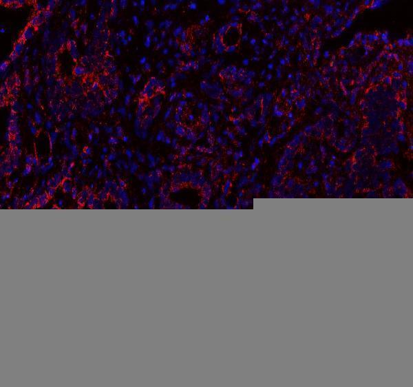 a05357 2 mlst8 primary antibodies if testing 8