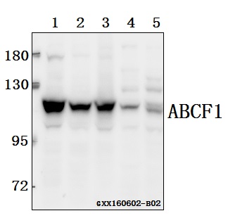 Western blot (WB) analysis of ABCF1 polyclonal antibody at 1:500 dilution
Lane1:SGC7901 whole cell lysate(40ug)
Lane2:HCT116 whole cell lysate(40ug)
Lane3:HCC827 whole cell lysate(40ug)
Lane4:The Testis tissue lysate of Mouse(40ug)
Lane5:The Testis  tissue lysate of Rat(40ug)