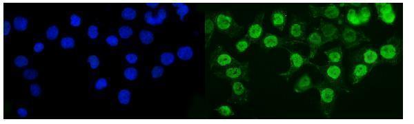 a05361 2 suv39h2 primary antibodies if testing 9