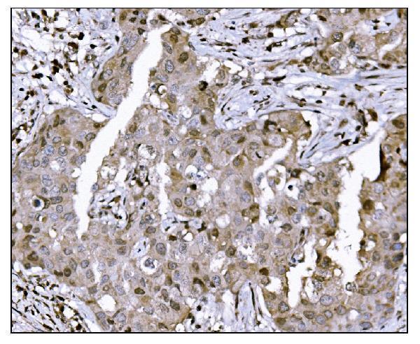 a05361 2 suv39h2 primary antibodies ihc testing 3