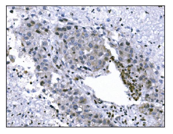 a05361 2 suv39h2 primary antibodies ihc testing 4