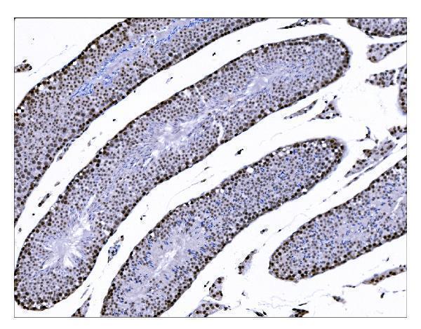 a05361 2 suv39h2 primary antibodies ihc testing 7