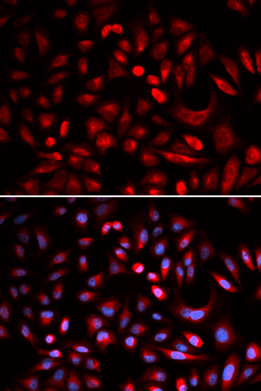 a05366 1 prkacb primary antiboties ihc testing 3