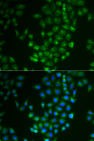 a05366 1 prkacb primary antiboties ihc testing 4