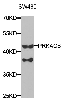 a05366 1 prkacb primary antiboties wb testing 1