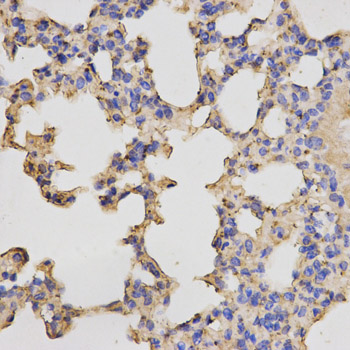 a05366 1 prkacb primary antiboties wb testing 2