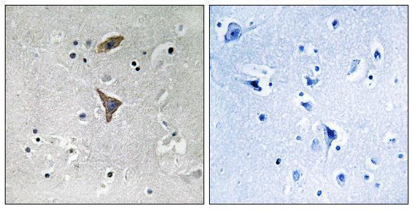Immunohistochemistry analysis of paraffin-embedded human brain tissue, using KCNT1 Antibody