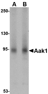 a05368 1 aak1 primary antibodies wb testing 1