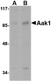a05368 aak1 primary antibodies wb testing 1