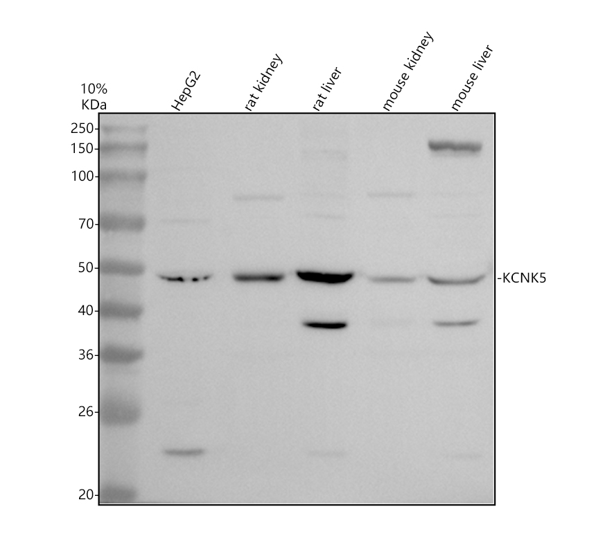 Western blot analysis of KCNK5 using anti-KCNK5 antibody (A05369-1)