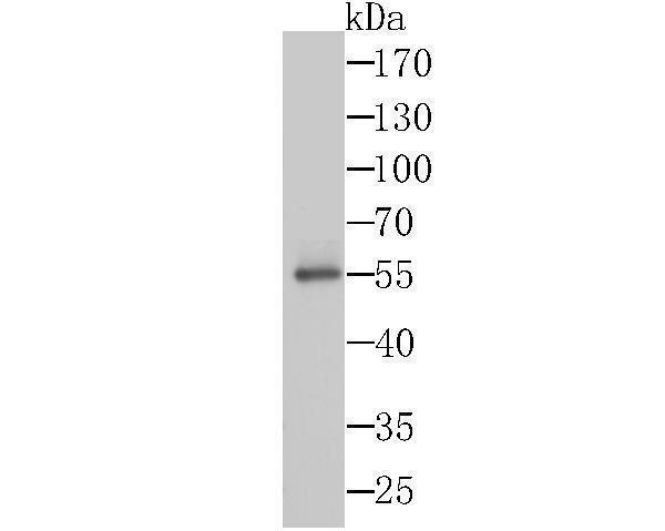 Western blot analysis of Syntrophin alpha 1 on SiHa cells lysates using anti-Syntrophin alpha 1 antibody at 1/1,000 dilution