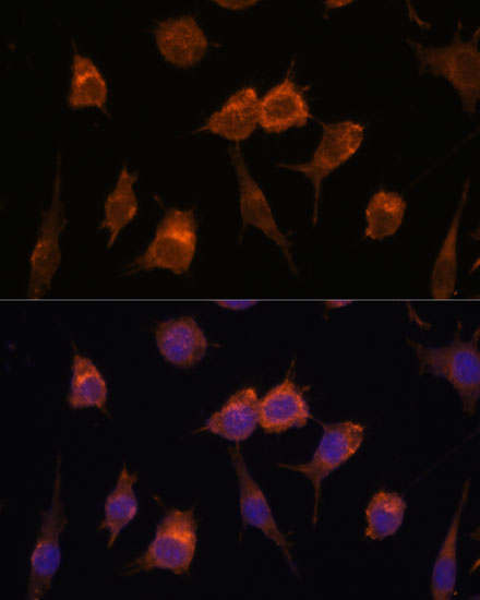 Immunofluorescence analysis of L929 cells using AVIL antibody  at dilution of 1:100