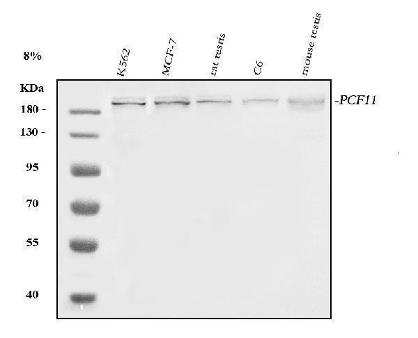  Western blot analysis of PCF11 using anti-PCF11 antibody (A05372-1)