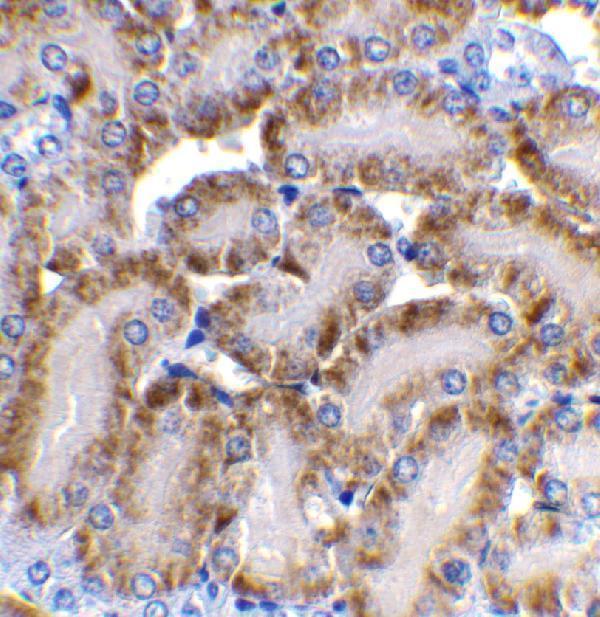 Immunohistochemistry of CAD in mouse kidney tissue with CAD antibody at 2 μg/mL