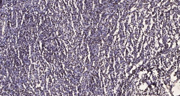 Immunohistochemical analysis of paraffin-embedded human brain tumor