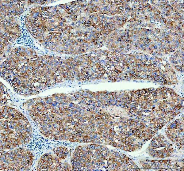  IHC analysis of ASGR1 using anti-ASGR1 antibody (A05376-1)