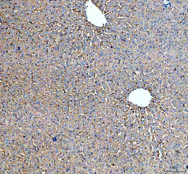 a05376 1 asgr1 primary antibodies ihc testing 4